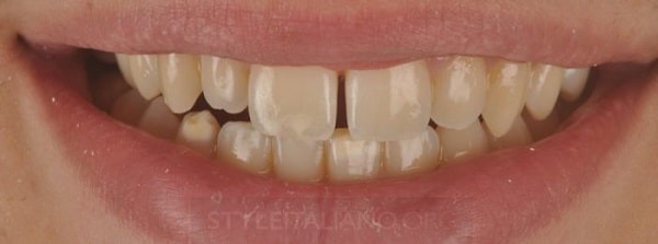 Hình 1. Tình trạng ban đầu