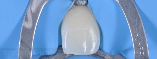 Hình 13. Đặt đê cao su