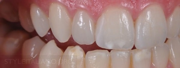 Hình 19. Cận cảnh mặt bên