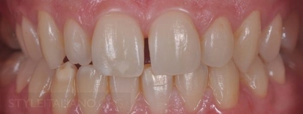 Hình 2. Nhìn ở trực diện
