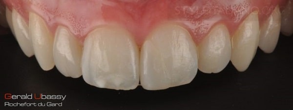 Hình 20. Kết quả cuối cùng
